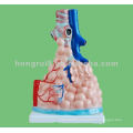 Enlarged Pulmonary Alveoli Model,Anatomical model